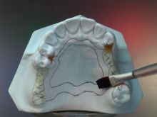 after survey, design and block out apply the Metaseal separator