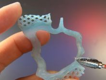 after light curing to acrylic the Metacon material can be trimmed