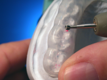 verify occlusion and glaze or polish