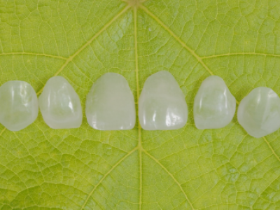 PREMIOtemp Multi - egg-shell veneers