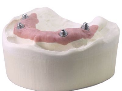 primostone IXO ivory