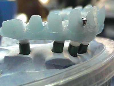 Implantatstruktur polymerisiert …