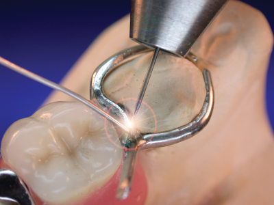 repair of broken clasp
