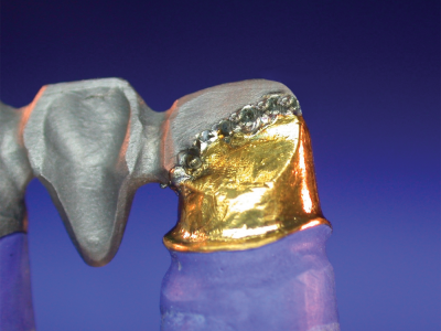 cast bridge element to Captek or electroformed coping