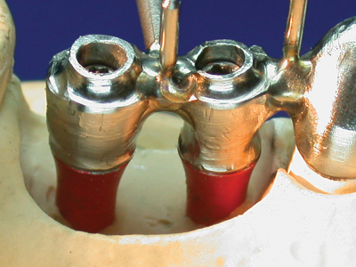 implant cases