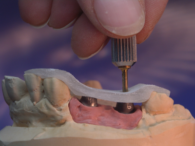 primosplint - transfer jig for abutments